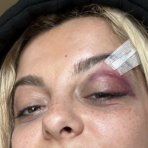 Audience Member Charged with Assault After Hitting Singer Bebe Rexha with Cell Phone at Manhattan Concert