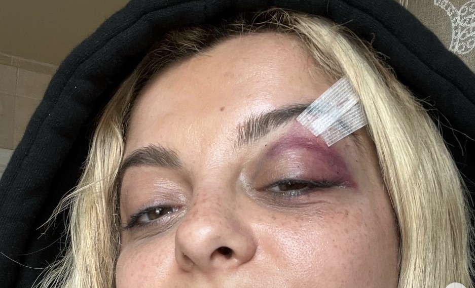 Audience Member Charged with Assault After Hitting Singer Bebe Rexha with Cell Phone at Manhattan Concert