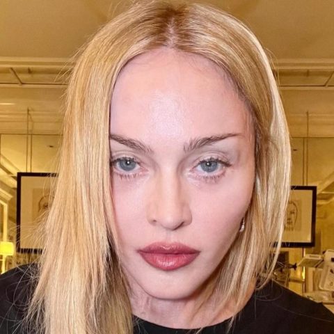 Madonna Shares Instagram Update on Her Ongoing Recovery