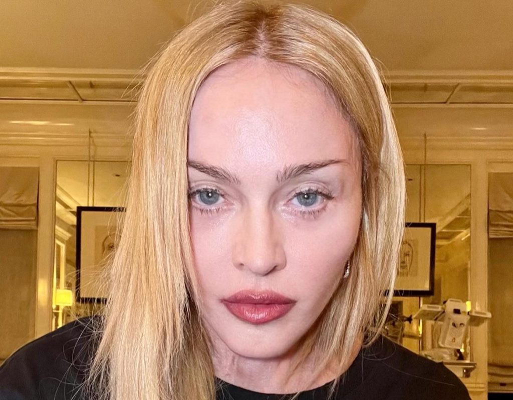 Madonna Shares Instagram Update on Her Ongoing Recovery